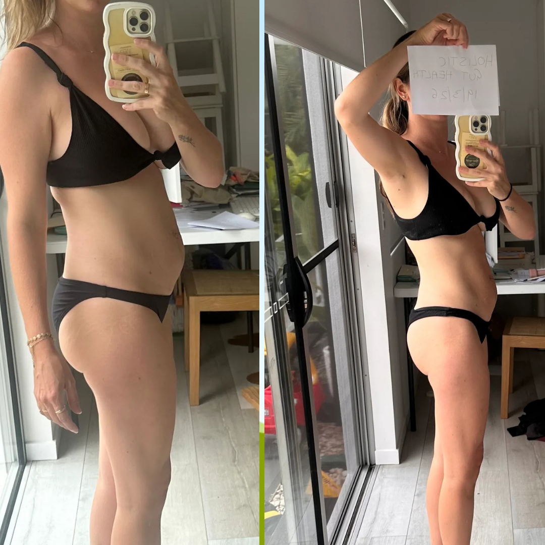 Before and after - Dani T.