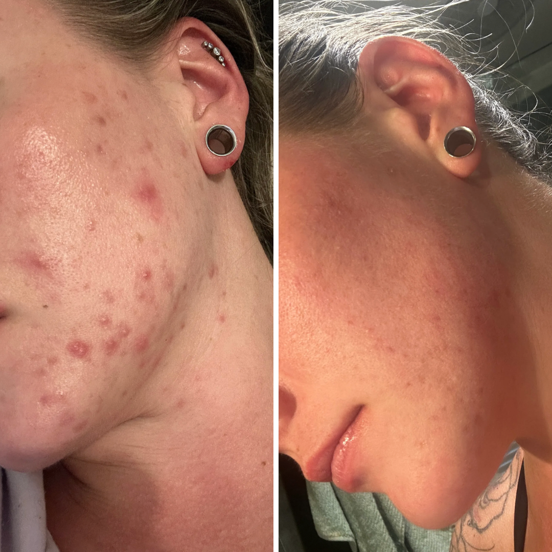 Before and after - Jessica P.