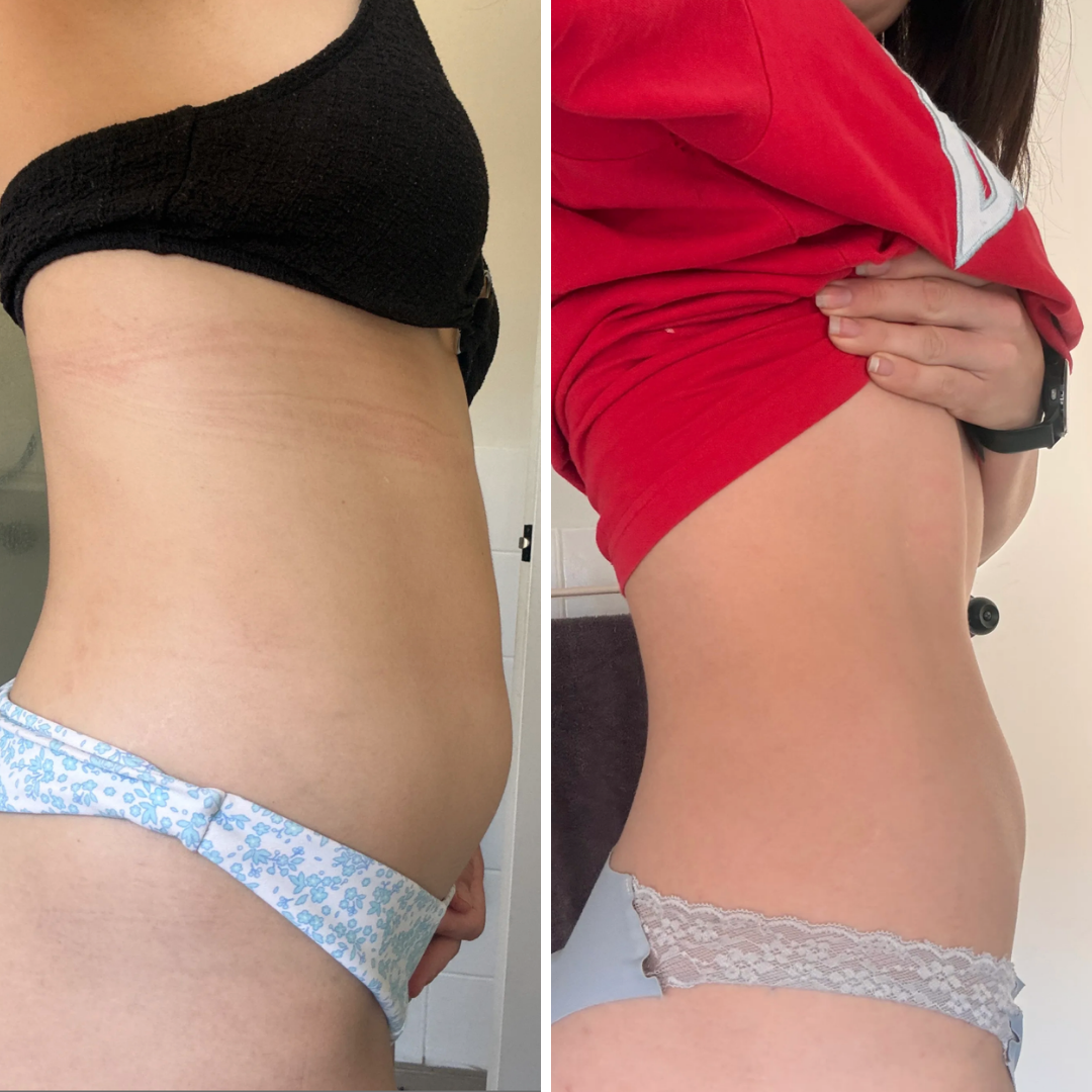 Before and after - Helen S.