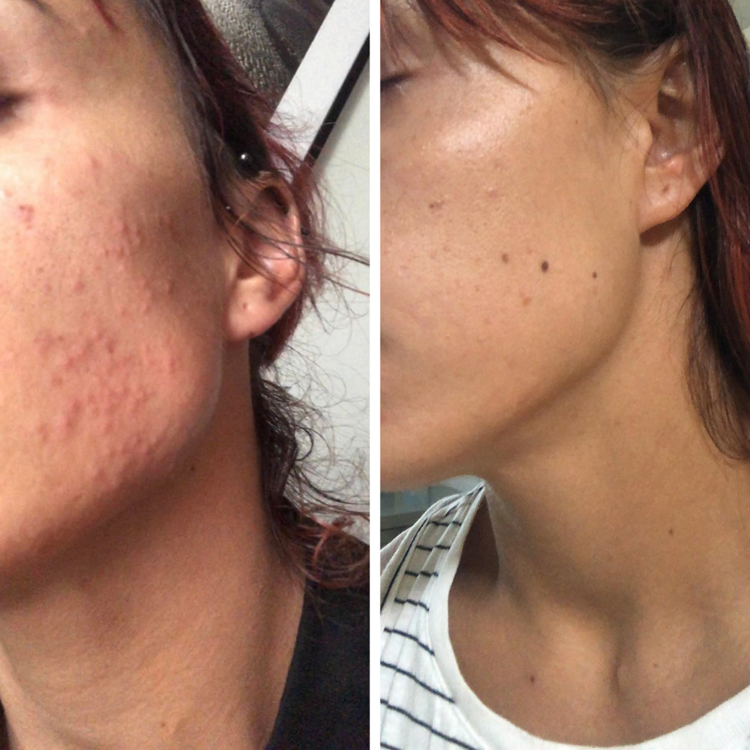 Before and after - Bayley P.