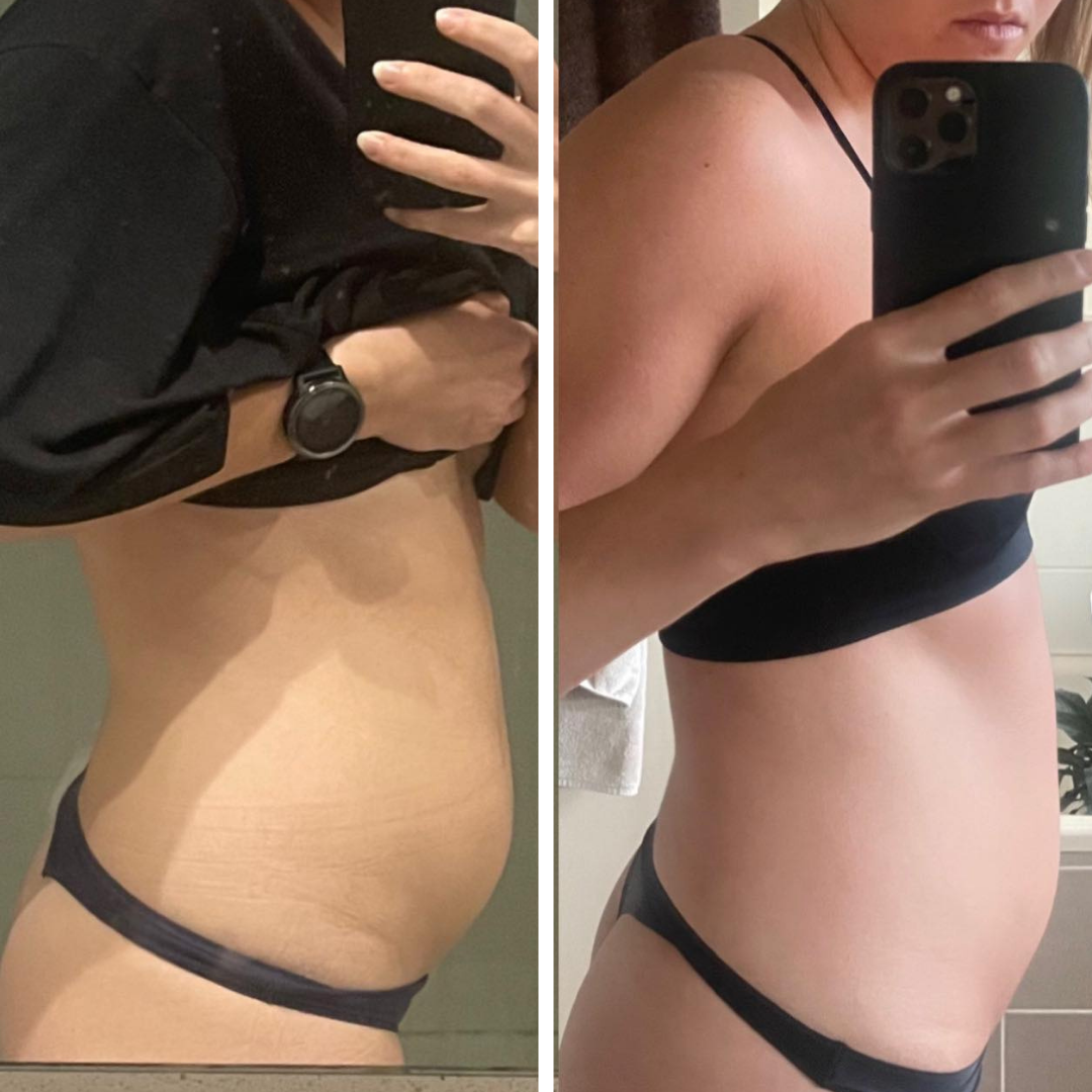 Before and after - Sally K.
