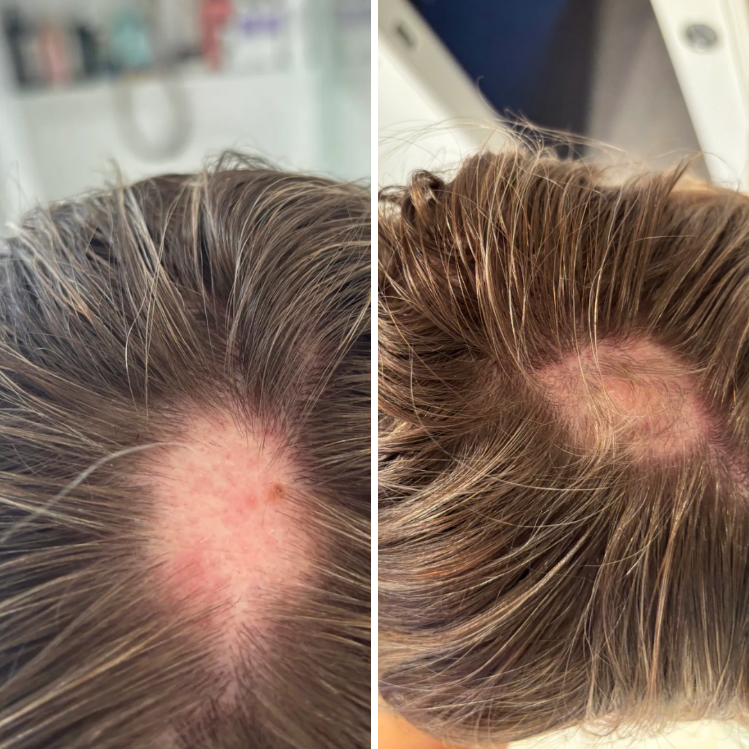 Before and after - Hope T.