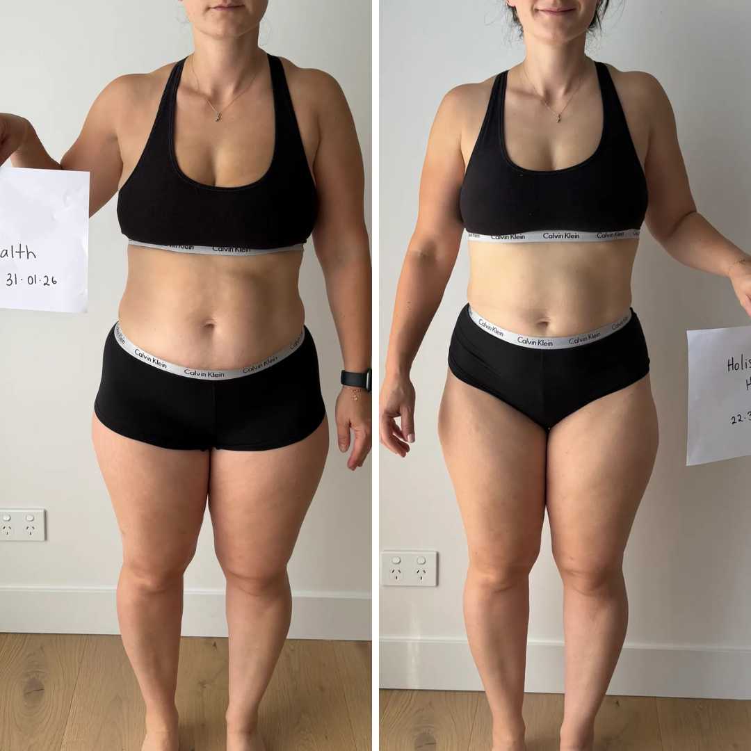 Before and after - Lily A.