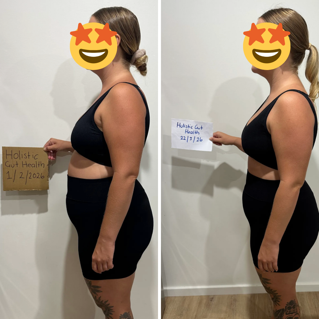 Before and after - Casey B.